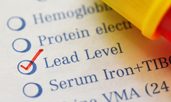 FDA's Outdated Lead Standards Put the Public's Health at Risk